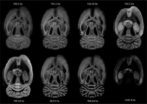 Brain x ray on display of the website