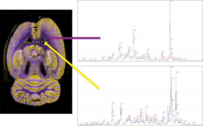 Brain Section with data on display of the website