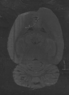 Dark shadowed brain on display of the website