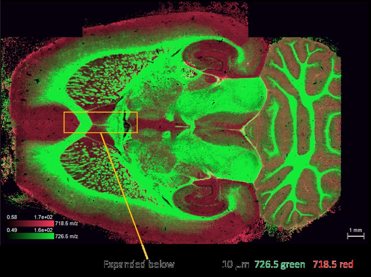Closeup shot of brain x ray on display